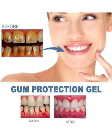 Indulgence Corner Teeth Whitening Pen - 2pc Set for Sensitive Teeth & Gums | Effective Tooth Stain Remover & Deep Clean - Buy Online on GoSupps.com
