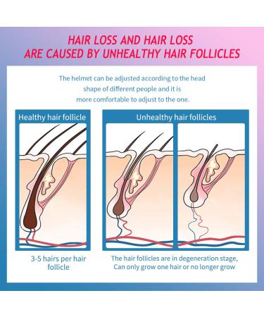 Gold Hair Regrowth Helmet & Cap System for Men & Women - Restoration & Treatment for Hair Loss - Buy Online on GoSupps.com