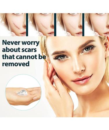 German Advanced Skin Renewal Gel Scar Gel For Acne Scars Stretch Mark Removal Cream Advanced Scar Treatment Natural Scar Therapeuti Gel Scar & Stretch Marks Remover Gel (3pcs) - Buy Online on GoSupps.com