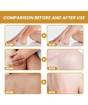 Turmeric Skincare Set 3 In 1 Turmeric Glowing Skin Care Set Beauty Gift Sets with Turmeric Glow Face Was Scrub Butter Dark Spot Corrector Remover Anti Aging Firming Facial Kits for Women - Buy Online on GoSupps.com