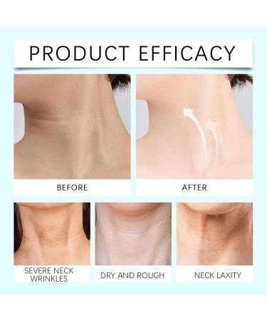 GoLashFun Collagen Neck Wrinkle Patches Anti Wrinkle Neck Patches Gentle Moisturizing And Firming Skin Smoothing Elastic Skin Care Neck Wrinkles Mask (Blue) - Buy Online on GoSupps.com