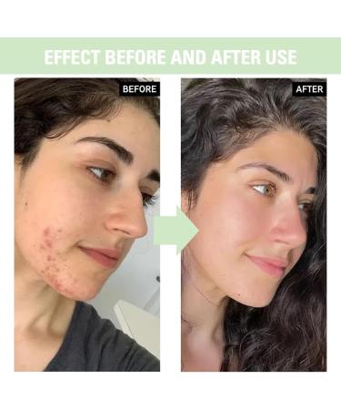 Panthenol Face Serum Niacinamide Serum Brightening Serum Hydrating Serum Korean Serum For Repair Dark Spot Corrector For Face Calming Serum Green Tea+Hyaluronic Acid Panthenol Cream - Buy Online on GoSupps.com