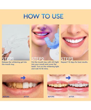 Professional Teeth Whitening Kit - 5X LED Light, 1 Mouth Tray, Desensitizing Gel, 3 Whitening Gels - 10 Minute Effect - Remove Stains at Home - 5 Piece Set - Buy Online on GoSupps.com