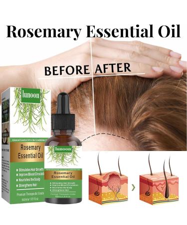 Buy 2 Essential Oils for Hair Growth & Dry Scalp Care - 60ml | Men's & Women's Hair Solutions - Buy Online on GoSupps.com