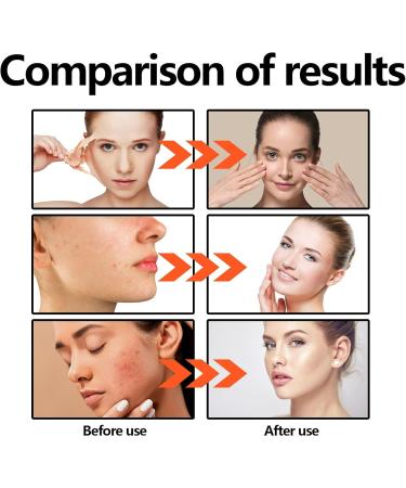  Orgrul Ocean Natural Soothing Face Cream for Women 118 ml Soothing Face Cream Nourishing Face Cream Facial Moisturizer (2 Pcs) - Buy Online on GoSupps.com