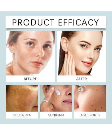 Dark Spot Treatment Cream with Vitamin C Retinol & Hyaluronic Acid Helps Reduce Appearance of Dark Spots Brighten and Even Skin Tone rich in vitamins& antioxidants49% active blend1.76 oz - Buy Online on GoSupps.com