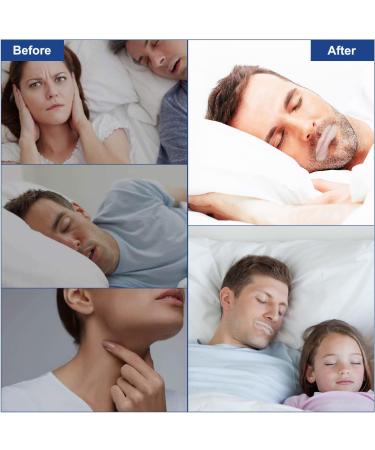 Anti Snoring Mask - 90-Piece Sleep Straps for Improved Sleep Quality - Buy Online on GoSupps.com