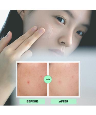 URBANAND Morning Fresh Capsule cream, Vegan Skin Care, Face Moisturizer for Skin Radiance, Lighgtweight gel for Glow Hydration, Korean Skin Care (5.07 fl oz.) - Buy Online on GoSupps.com