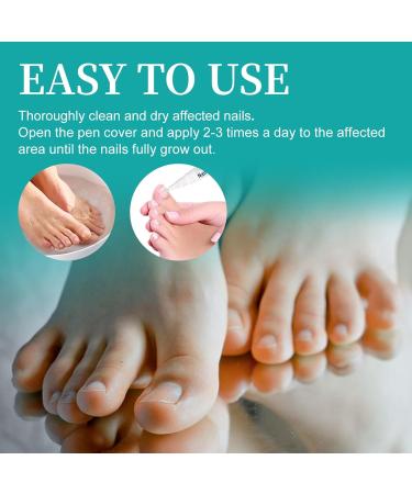 Fungal Nail Serum Pen with Tea Tree Oil and Aloe - Extra Strong Treatment for Toenails and Fingernails - Improve Damaged Nails - 1PCS - Buy Online on GoSupps.com