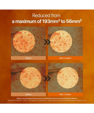 CAFFEINE SHOT Blemish Toning Serum & BANANA Conceal Eye Cream, Even Skin Tone, Reduced Pore Size and Puffiness, Lightweight, Korean Skin Care - Buy Online on GoSupps.com