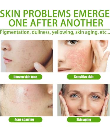 Centella Calming Gel Cream Face Moisturiser For Neck Face And Eye Acne Cream With Nicotinamide And Licorice Root extract Moisturiser Face Women Facial Care Face Cream For All Skin Types.(60ml) - Buy Online on GoSupps.com