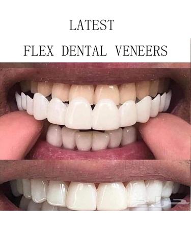 Giural 2-Piece Upper Teeth Denture - Temporary Anti-Real Prosthesis Reusable Adult Whitening Veneer for Comfortable Dental Care - Buy Online on GoSupps.com