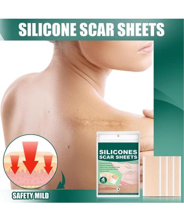 Professional Silicone Scar Removal Sheets - Reusable Gel Strips for Keloid, C-Section, Surgery, Burn, Acne - Stretch Marks Patch Away Tape - Buy Online on GoSupps.com