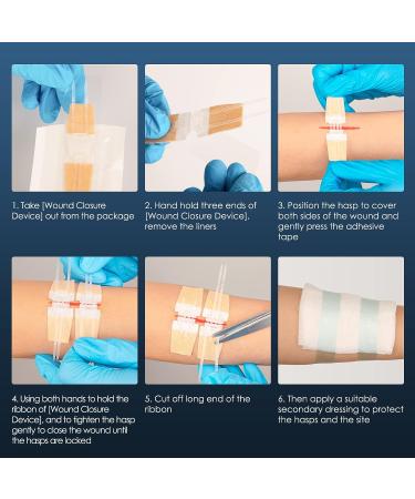 Wound Closure Strip 6 pcs - Sterile First Aid Kit Zip & Stitch Suture-Free Flexible Fabric Bandages for Skin Injury - Buy Online on GoSupps.com
