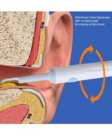 TUORE 1080P Ear Cleaning Camera with LED Light for iOS, WiFi Otoscope for Ear Wax Removal - APP Control (White) - Buy Online on GoSupps.com