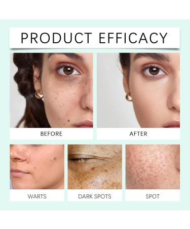 JOYVOIDX Gentle Renewing Skin Gel with Avocado Oil & Seaweed Extract Targeted Care for The Appearance of Dullness & Dark Spots Even-Toning Gel 1.76oz - Buy Online on GoSupps.com