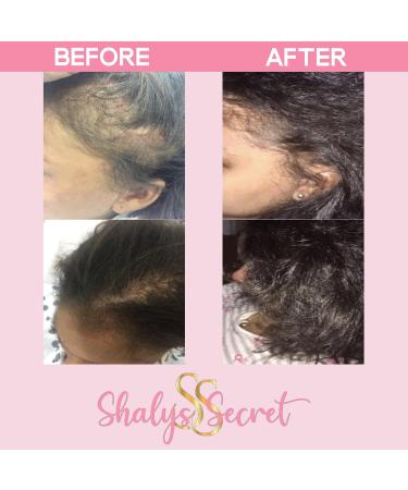 Hair Growth Oil | Nourishing Treatment for All Hair Types | Promotes Healthier & Longer Hair | 1.7 oz - Buy Online on GoSupps.com