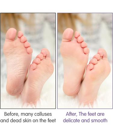 Bubuyun 10PCS Foot Pumice Stone | Callus Remover for Hard Skin | Double Sided Pumice Stone for Feet & Body | Purple (12.5x2.5cm) - Buy Online on GoSupps.com