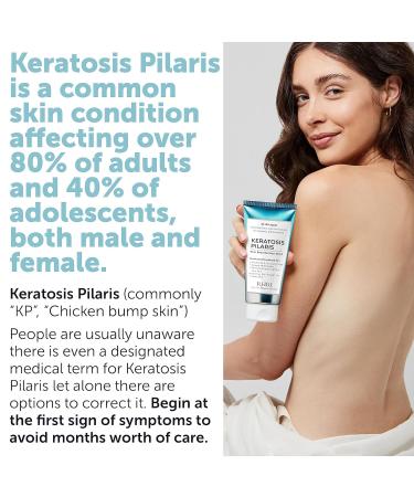 Keratosis Pilaris Treatment | Keratosis Pilaris Lotion with 10% AHA | Gentle Exfoliation For Strawberry Legs, KP & Ingrown Hairs | Smooth & Hydrating Body Lotion For Redness, Dry, Rough And Flaky Skin KP Lotion - Buy Online on GoSupps.com