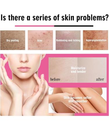 New Strawberry Shortcake Body Juice Oil | Earth Berry Essence Care | Women's Fruit Massage Oil - Buy Online on GoSupps.com