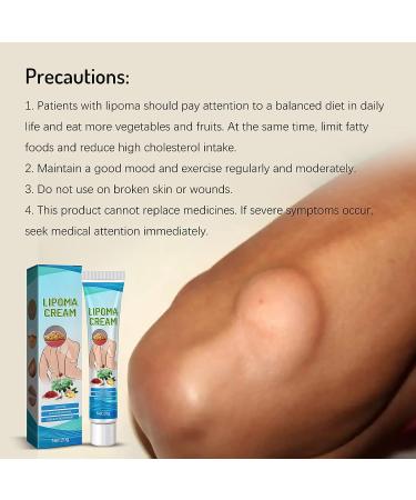 Lipoma Removal Cream 20g - Natural Treatment for Lipoma Care & Discomfort - Buy Online on GoSupps.com