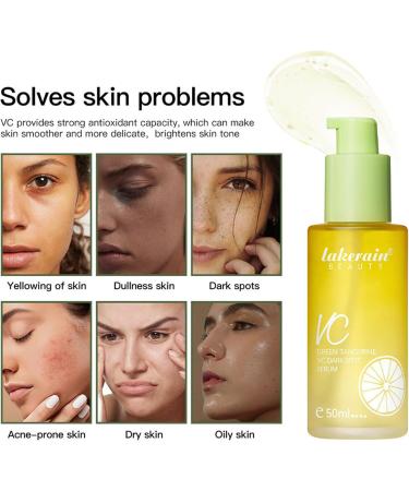 Green Tangerine Vitamin C Serum - Dark Spot Remover Facial Serum - Intensive Dark Circle Relief Hyperpigmentation Anti-Aging and Acne Scars - Brightening Moisturizing Face Serum - Buy Online on GoSupps.com