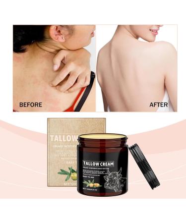  KOAHDE Sebum and honey balm firming and moisturizing sebum face cream sebum skin care cream sebum for the skin 120 g - Buy Online on GoSupps.com