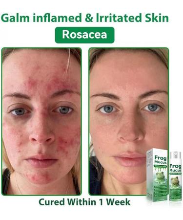  YNPQTDS Moisturizing Body Spray for Dry Skin 20ml - Face Spray - Moisturizing Repairing Hydrating Radiance Soothing for Dry Skin - Buy Online on GoSupps.com