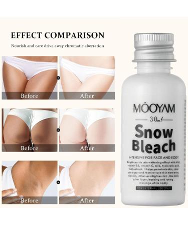  Zankie 1/2 Lightening Cream for - 30ml Dark Spot Correction Cream Brightening Cream for Intimate Areas Brightening Cream for Body and Sensitive Areas - Buy Online on GoSupps.com