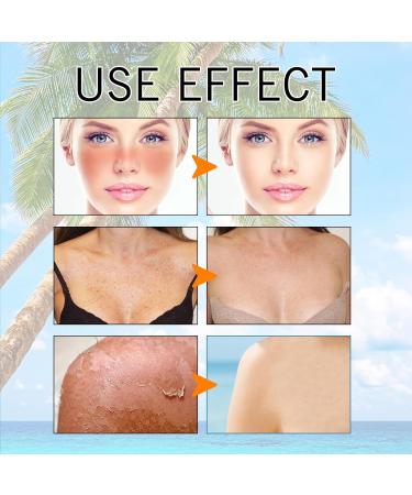 KOAHDE Hyaluronic Acid Sunscreen Hyaluronic Acid Watery Sun Gel Hyaluronic Acid Natural Sun Cream Moisturizing Physical Sun Block Natural Moisturizing Suncream Waterproof Sun Gel 50ML 1PC - Buy Online on GoSupps.com