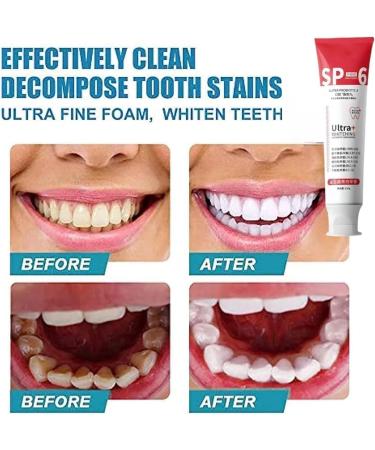 Ultra Whitening Toothpaste Sp-6 Probiotic Whitening Toothpaste Sp-6 Whitening and Stain Removing Toothpaste Deep Cleaning Toothpaste Prevents Tartar - Buy Online on GoSupps.com