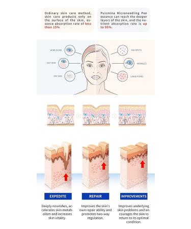 Puicmlna Microneedling Pen 20 Pcs Disposable Needles - 0.1mm Size with Pin & Nano Cartridges | 42-pin, 36-pin, 12-pin for Dermaroller Replacement - Buy Online on GoSupps.com