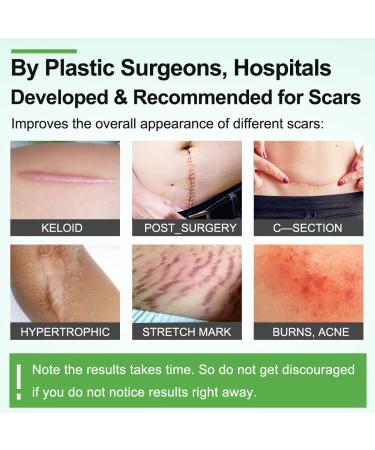 Silicone Scar Sheets Tape Strips 16 Pcs - Keloid C-Section Tummy Tuck Healing - Surgery Scars Treatment - Buy Online on GoSupps.com