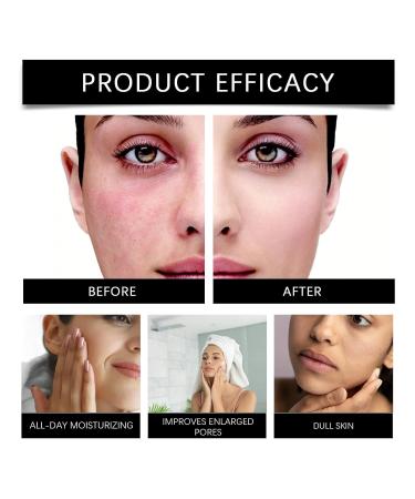 TS TAC-SKY Gentle Moisturizing Brightening Skincare Oil - Portable Nourishing Anti-Pollution Reduces Dryness & Flakiness(1PCS) - Buy Online on GoSupps.com