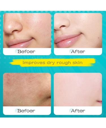 RedOceansM Womens Face Mask Daily Care Facial Cloth Masks 6 Pieces Collagen Hydrogel Face Mask Moisturizing Skin Firming Increases Skin Moisture for All Skin Types - Buy Online on GoSupps.com