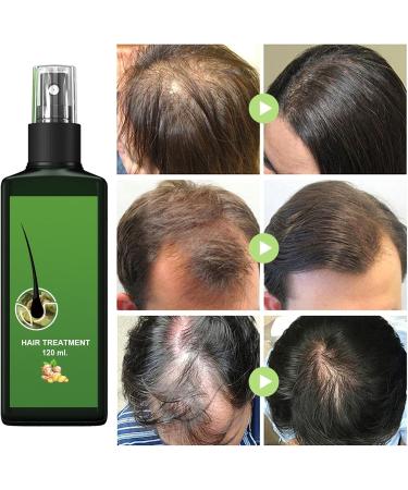 Shantou Yingji Nourishing Ginger Nourishing Spray Ginger Hair Growth Serum AntiHair Loss 2 Pieces x 120 ml - Buy Online on GoSupps.com