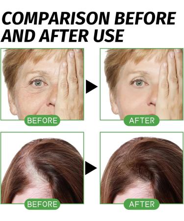 Castor Oil for Hair Growth Pure Naturals Cold Pressed Hair Growth Oil for Women Men Promote Hair Growth Strengthen Hair Roots and Prevent Bifurcation 60ML - Buy Online on GoSupps.com