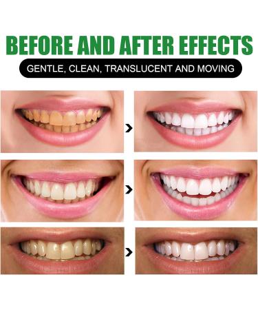 Bamboo Charcoal Deep Toothpaste 100g - Natural Whitening & Deep Cleaning Activated Carbon Toothpaste - Buy Online on GoSupps.com