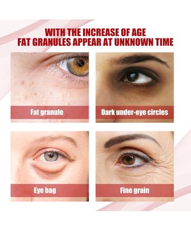 Milia Remover Milia Spot Serum for Face Speedy Milia Remover Dark Spot Correcting Glow Serum Dark Circles Under Eye for Women & Men Anti Aging Anti Wrinkle Reduces Bags Saggy Skin & Puffy Eyes - Buy Online on GoSupps.com