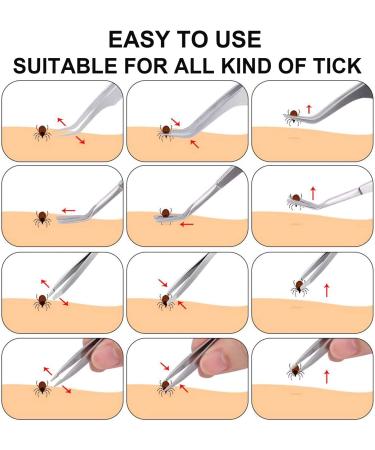 EasyULT 3PCS Tick Remover Tool Set Tick Removal Tool Stainless Steel Tick Remover Tick Hook Kit Included Removal Tweezers+ Tick Shovel for Animals for Humans Dogs Cats 3Pi ces - Buy Online on GoSupps.com