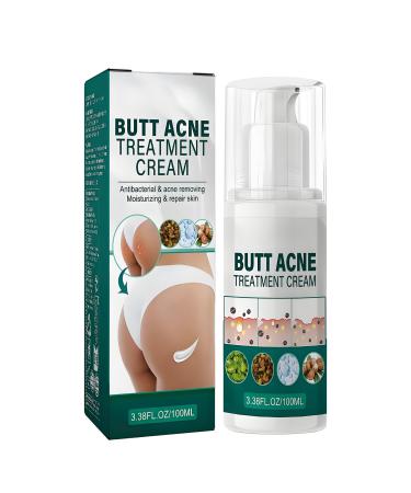 Cr me nettoyante contre l'acn pour les fesses et les cuisses 100 ml de cr me d'acn pour les fesses cr me nettoyante anti-acn cr me anti-boutons sur les fesses limine les boutons et les taches