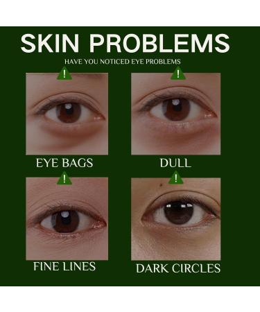 Mint Essence Serum Roller - Under Eye Cream - Eye Bags Remover - Eye Cream for Dark Circles and Puffy Eyes - Anti Wrinkle Eye Cream - Brighting Moisturing and Cooling Feeling 10ML - Buy Online on GoSupps.com