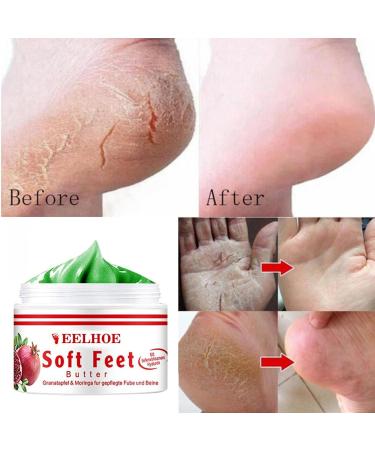 Regeneration Foot Care Cream for Cracked Heels & Dry Feet - Optimal Skin Repair Ointment for Visible Cornea Reduction (1g Pack) - International Shipping - Buy Online on GoSupps.com