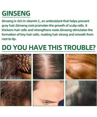 100ml Serum Pousse Cheveux S rum Pour La Pousse Des Cheveux D'essence Naturelle de Croissance des Cheveux Contient du Ginseng Favorise la Croissance Naturelle des Cheveux Ingwer - Buy Online on GoSupps.com