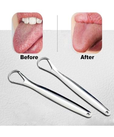 2 Pieces Stainless Steel Tongue Cleaner Set - Bad Breath Remedy & Oral Hygiene Tool for Adults & Children - Buy Online on GoSupps.com