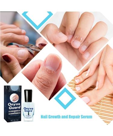6PCS Nail Strengthener for Weak Nails Nail Conditioner for Damaged Nails Onyxoguard Nail Growth and Repair Essence Nail Hardener Extra Strong and Growth Nail Guards for Strength - Buy Online on GoSupps.com