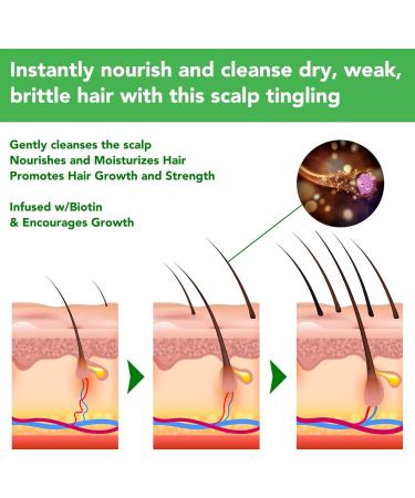 Rosemary Shampoo Hair Growth 300ML Rosemary Shampoo Anti Hair Loss Soap Hair Regrowth Shampoo for Dry and Brittle Hair - Buy Online on GoSupps.com