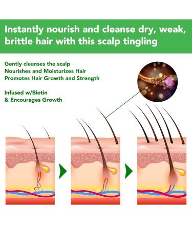 Hair Growth Serum & Rosemary Shampoo - Biotin & Castor Oil for Hair Loss | Effective Regrowth Products for Women & Men - Buy Online on GoSupps.com
