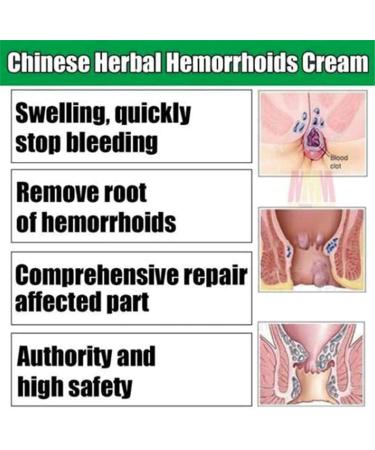 6PCS Chinese Herbal Hemorrhoids Cream | Painless Relief | Maximum Strength Anal Cream - Buy Online on GoSupps.com