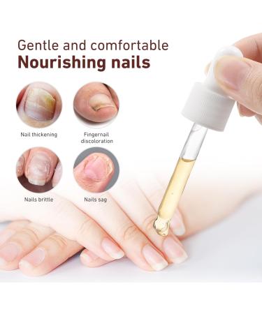 minkissy Nail Repair Serum Nail Repair Liquid for Toenail and Fingernail Nail Repair Solution for Thick Cracked Discolored Nails Restore Healthy Nails - Buy Online on GoSupps.com